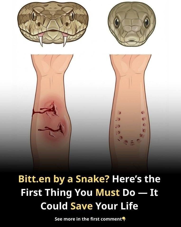Bitten by a Snake? Here’s the First Thing Experts Say You Should Do