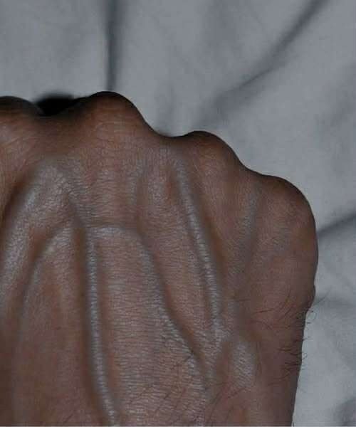 If You Have Visible Veins, Here’s What It May Actually Mean